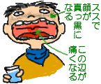 rKX]҂̐}